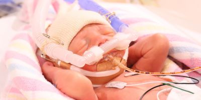 Baby being treated in the John Hunter Hospital NICU