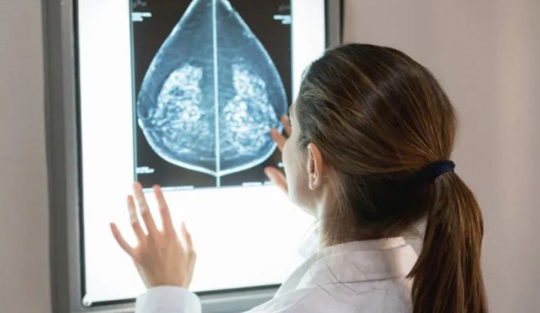 Female radiographer looking at lit up x-ray of breasts