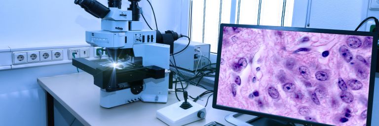 A stock image of a microscope and a computer screen displaying the results.